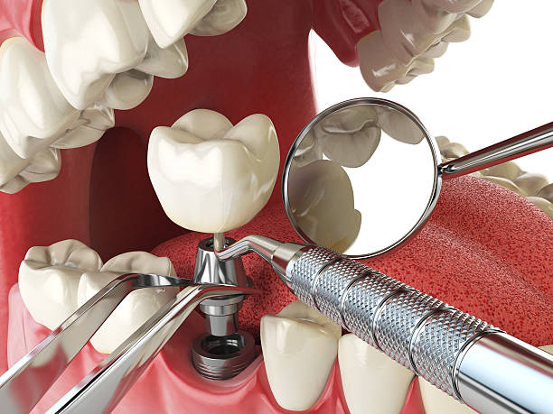 Best Pediatric Emergency Dentist in Toledo, IL
